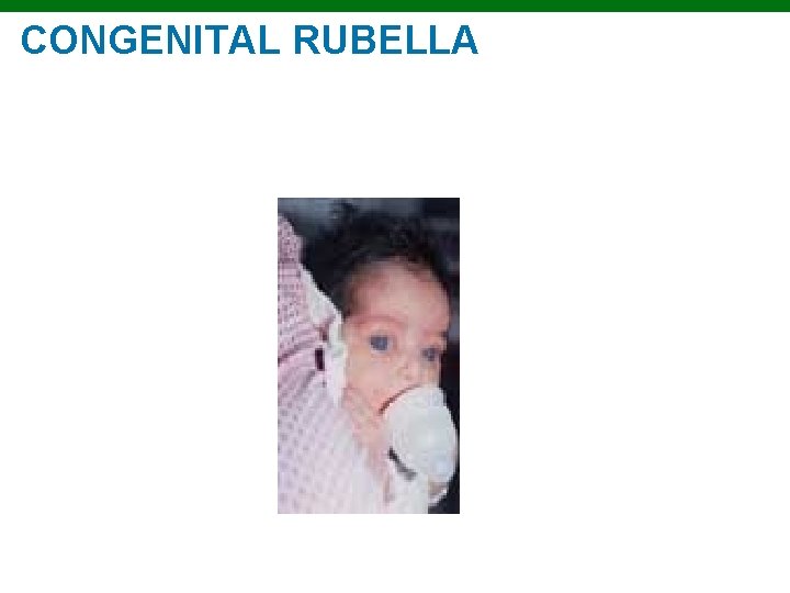 CONGENITAL RUBELLA Copyright © 2010 Pearson Education, Inc. 