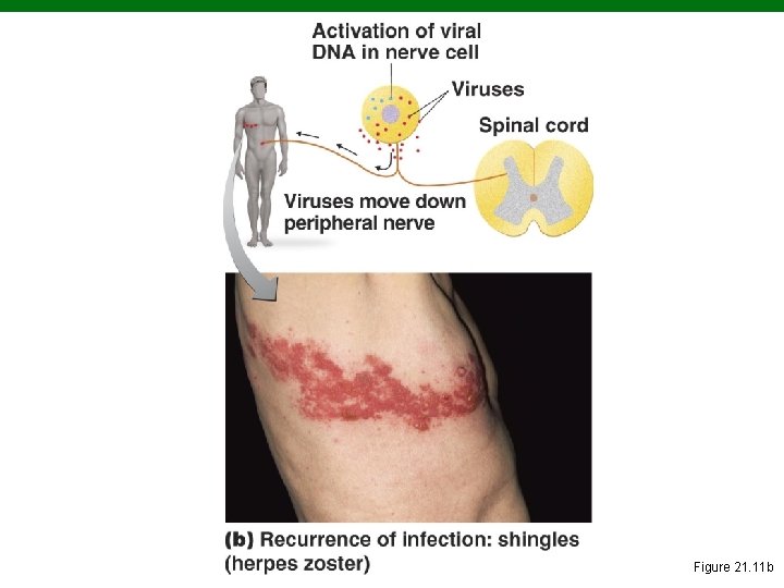 Copyright © 2010 Pearson Education, Inc. Figure 21. 11 b 