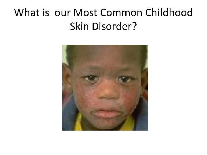 What is our Most Common Childhood Skin Disorder? 