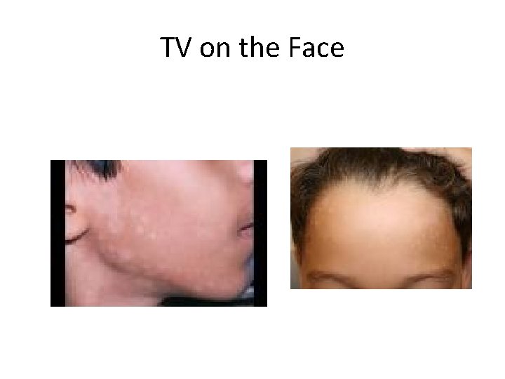 TV on the Face 