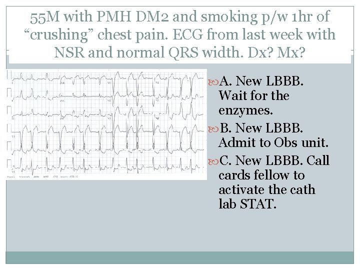 55 M with PMH DM 2 and smoking p/w 1 hr of “crushing” chest