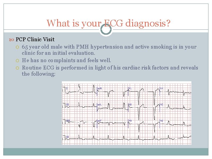What is your ECG diagnosis? PCP Clinic Visit 65 year old male with PMH