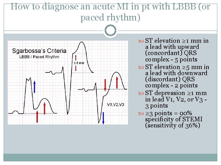 How to diagnose an acute MI in pt with LBBB (or paced rhythm) ST