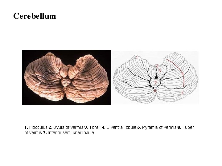 Cerebellum 1. Flocculus 2. Uvula of vermis 3. Tonsil 4. Biventral lobule 5. Pyramis