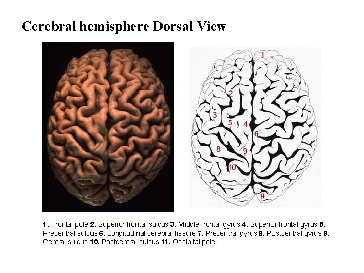 Cerebral hemisphere Dorsal View 1. Frontal pole 2. Superior frontal sulcus 3. Middle frontal