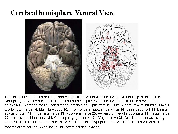 Cerebral hemisphere Ventral View 1. Frontal pole of left cerebral hemisphere 2. Olfactory bulb