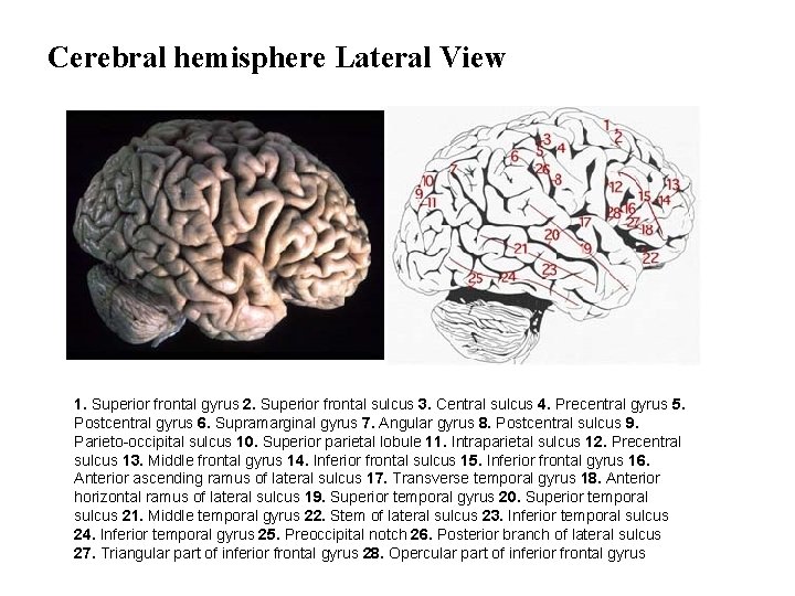 Cerebral hemisphere Lateral View 1. Superior frontal gyrus 2. Superior frontal sulcus 3. Central