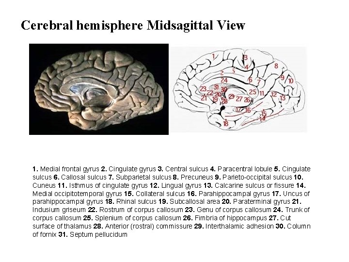 Cerebral hemisphere Midsagittal View 1. Medial frontal gyrus 2. Cingulate gyrus 3. Central sulcus