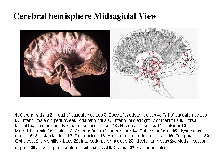 Cerebral hemisphere Midsagittal View 1. Corona radiata 2. Head of caudate nucleus 3. Body