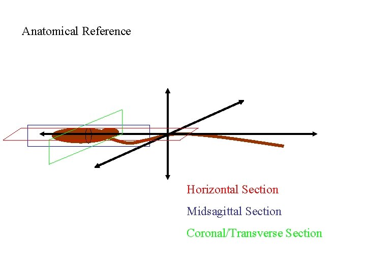Anatomical Reference Horizontal Section Midsagittal Section Coronal/Transverse Section 
