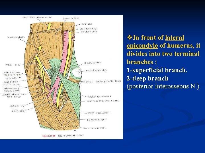 v. In front of lateral epicondyle of humerus, it divides into two terminal branches