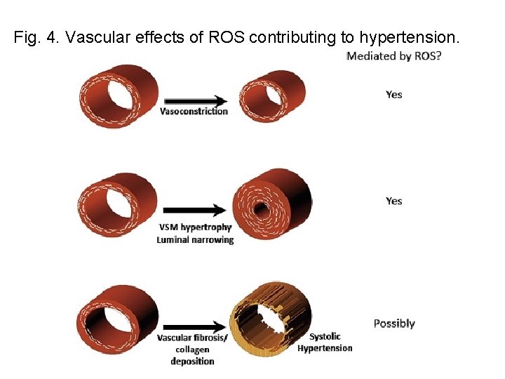  Fig. 4. Vascular effects of ROS contributing to hypertension. 