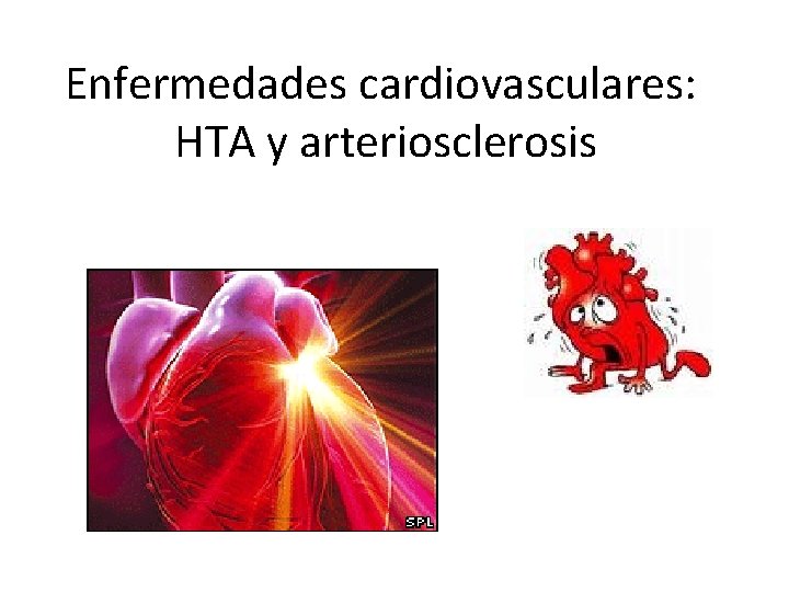 Enfermedades cardiovasculares: HTA y arteriosclerosis 