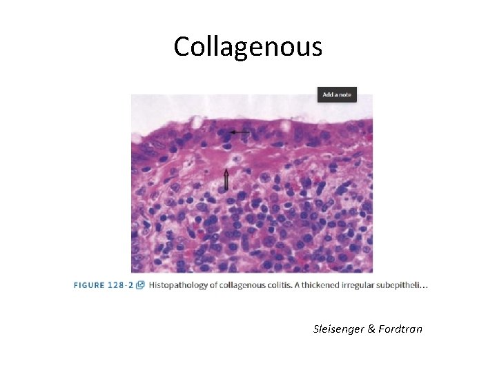 Collagenous Sleisenger & Fordtran 