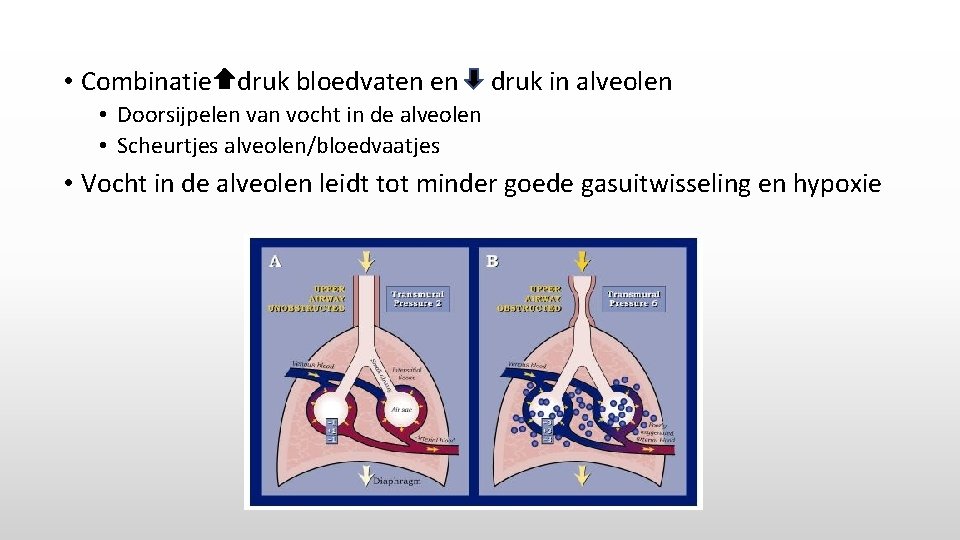  • Combinatie druk bloedvaten en druk in alveolen • Doorsijpelen van vocht in