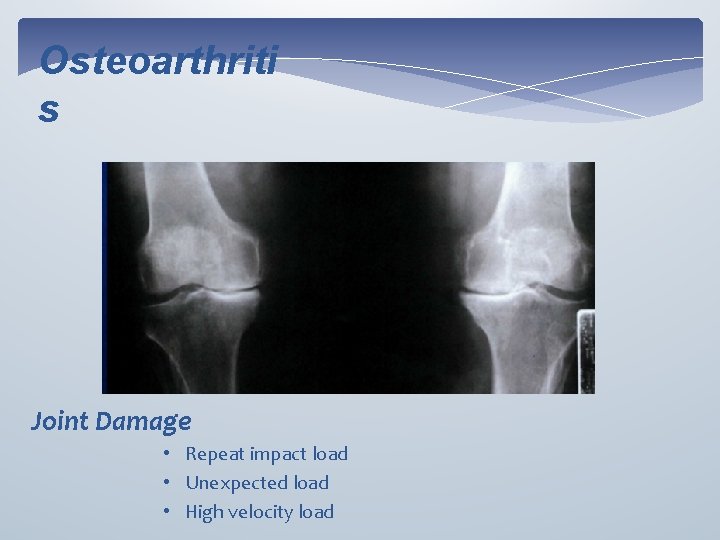 Osteoarthriti s Joint Damage • Repeat impact load • Unexpected load • High velocity