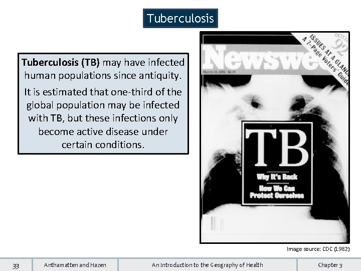 Tuberculosis (TB) may have infected human populations since antiquity. It is estimated that one-third