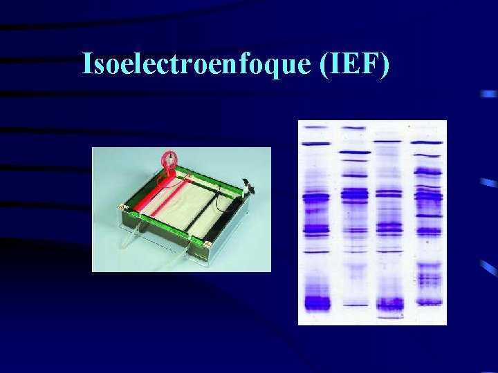 Isoelectroenfoque (IEF) 