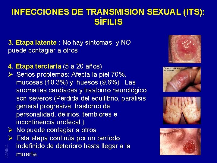 INFECCIONES DE TRANSMISION SEXUAL (ITS): SÍFILIS 3. Etapa latente : No hay síntomas y