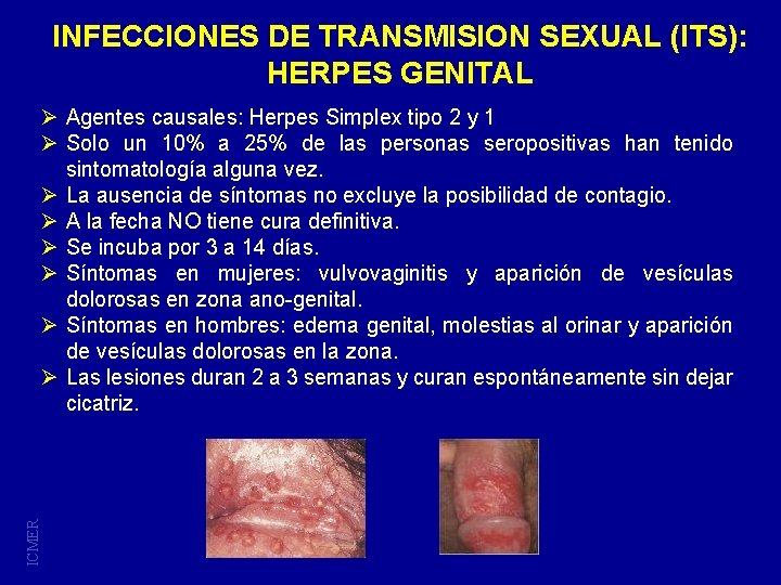 INFECCIONES DE TRANSMISION SEXUAL (ITS): HERPES GENITAL ICMER Ø Agentes causales: Herpes Simplex tipo