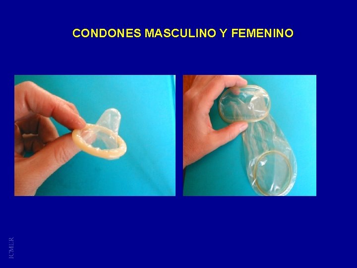 CONDONES MASCULINO Y FEMENINO 