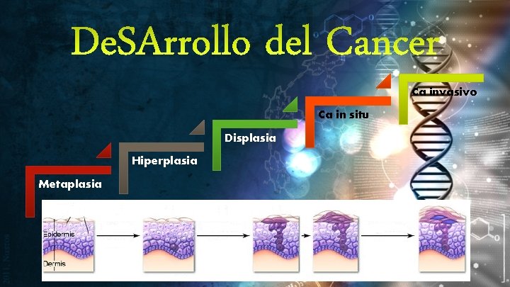De. SArrollo del Cancer Ca invasivo Ca in situ Displasia Hiperplasia Metaplasia 