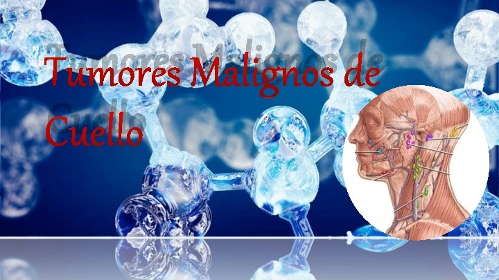 Tumores Malignos de Cuello 