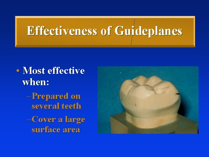 Effectiveness of Guideplanes • Most effective when: – Prepared on several teeth – Cover Effectiveness of Guideplanes • Most effective when: – Prepared on several teeth – Cover