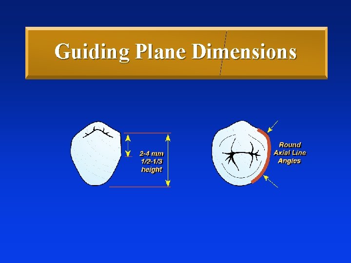 Guiding Plane Dimensions Guiding Plane Dimensions