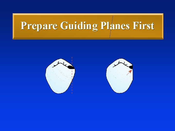 Prepare Guiding Planes First 