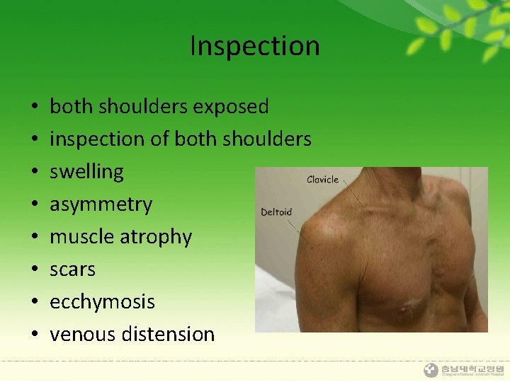 Inspection • • both shoulders exposed inspection of both shoulders swelling asymmetry muscle atrophy