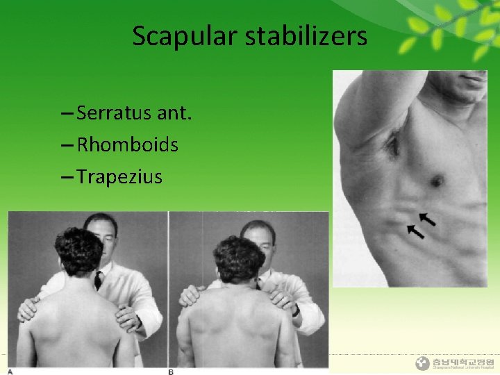 Scapular stabilizers – Serratus ant. – Rhomboids – Trapezius 