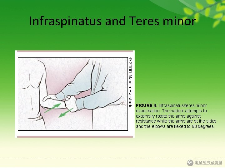 Infraspinatus and Teres minor FIGURE 4. Infraspinatus/teres minor examination. The patient attempts to externally