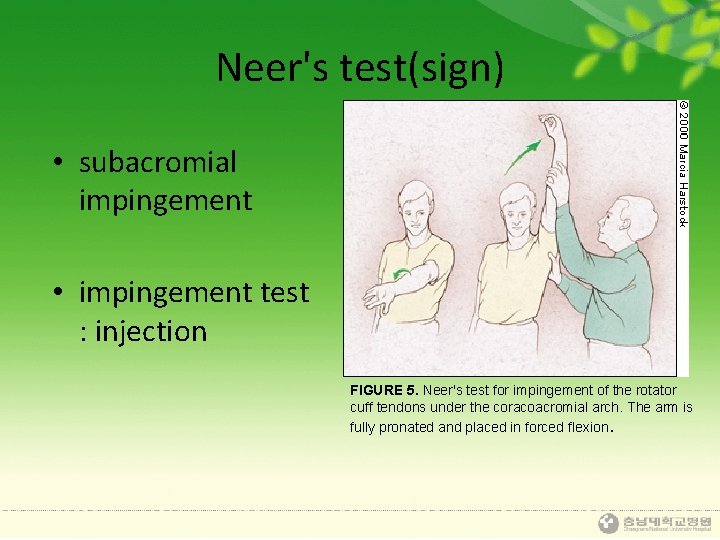 Neer's test(sign) • subacromial impingement • impingement test : injection FIGURE 5. Neer's test