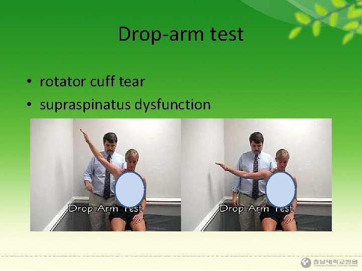 Drop-arm test • rotator cuff tear • supraspinatus dysfunction 