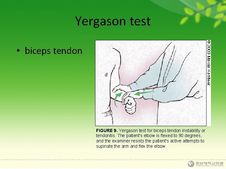 Yergason test • biceps tendon FIGURE 9. Yergason test for biceps tendon instability or