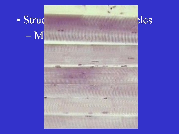  • Structure of Skeletal Muscles – Muscle fibers 