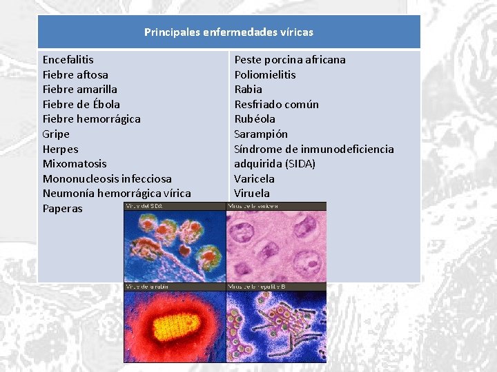 Principales enfermedades víricas Encefalitis Fiebre aftosa Fiebre amarilla Fiebre de Ébola Fiebre hemorrágica Gripe