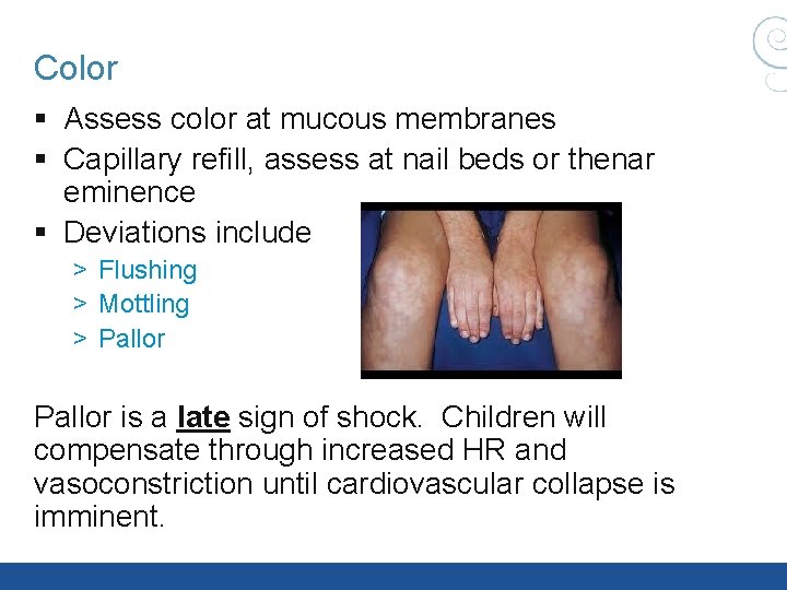 Color § Assess color at mucous membranes § Capillary refill, assess at nail beds Color § Assess color at mucous membranes § Capillary refill, assess at nail beds