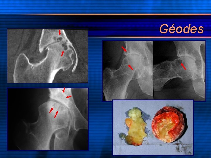Géodes 