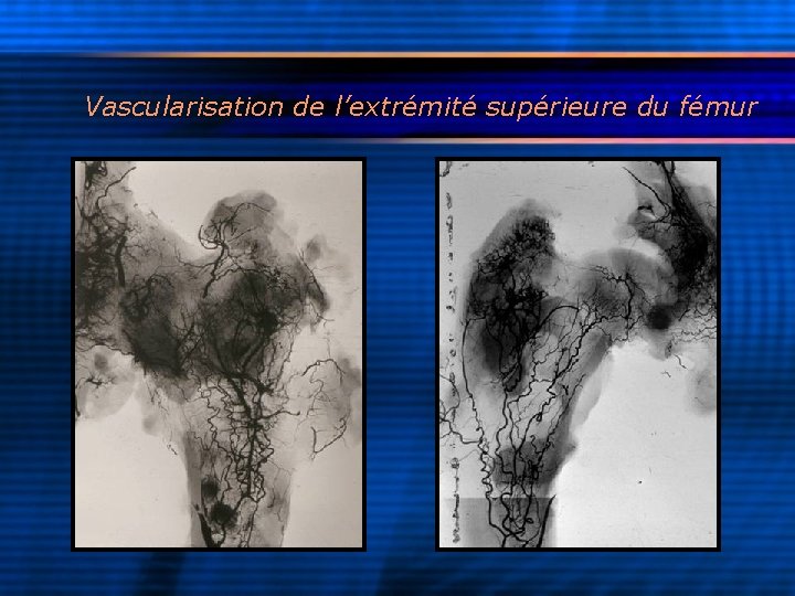 Vascularisation de l’extrémité supérieure du fémur 