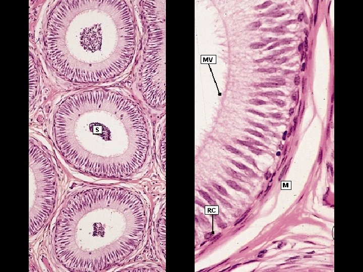 Modello Anatomico Bacino Maschile – Sezione Sagittale – Organi Genitali E Muscoli Pelvici – PVC Ecologico - 2