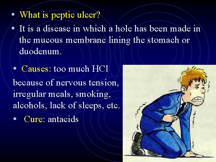 • What is peptic ulcer? • It is a disease in which a • What is peptic ulcer? • It is a disease in which a