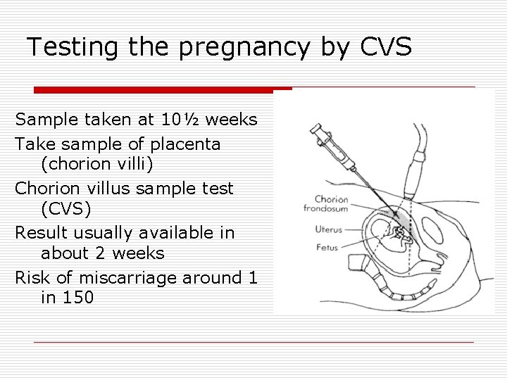 Testing the pregnancy by CVS Sample taken at 10½ weeks Take sample of placenta
