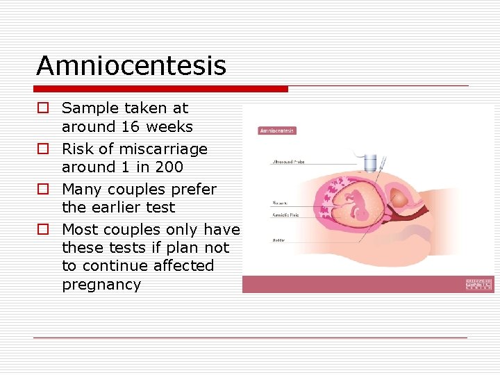 Amniocentesis o Sample taken at around 16 weeks o Risk of miscarriage around 1