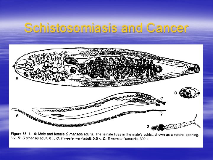 Schistosomiasis and Cancer 