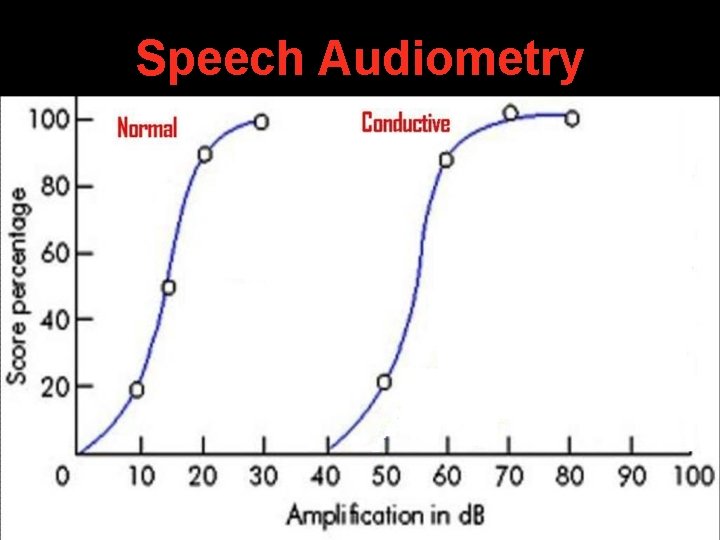 Speech Audiometry Speech Audiometry