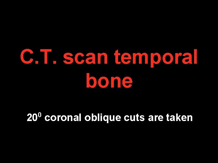 C. T. scan temporal bone 200 coronal oblique cuts are taken C. T. scan temporal bone 200 coronal oblique cuts are taken