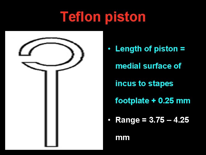 1 cm Teflon piston • Length of piston = medial surface of incus to 1 cm Teflon piston • Length of piston = medial surface of incus to
