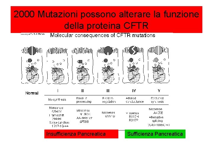 2000 Mutazioni possono alterare la funzione della proteina CFTR Insufficienza Pancreatica Sufficienza Pancreatica 